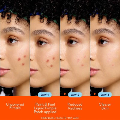 Biore Paint & Peel Liquid Pimple Patch Acne Spot Treatment with Salicylic Acid 0.50oz - Imperfect Box - Image 5
