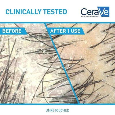 CeraVe Anti-Dandruff Scalp Care Shampoo - 12 fl oz - Image 4