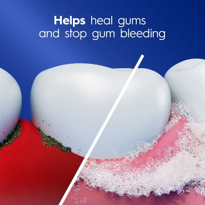 Crest Pro-Health Gum Detoxify Deep Clean Toothpaste 4.8oz/2pk - Missing Box - Image 5