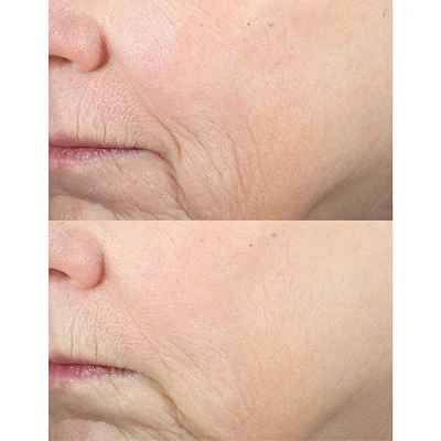 derma e Advanced Peptides & Collagen Serum 2 fl oz - New - Image 6