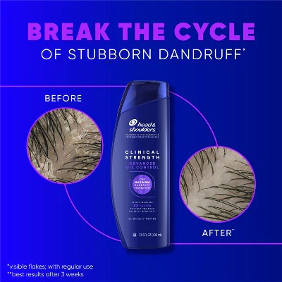 Head & Shoulders Clinical Strength Anti-Dandruff Citrus 13.5 fl oz - Imperfect Container - Image 7