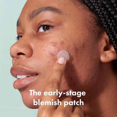 Hero Mighty Patch Micropoint for Blemishes 8ct - Imperfect Box - Image 3
