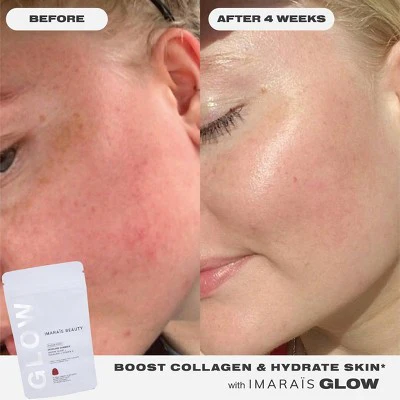 Imarais Beauty Glow Skincare Gummies Vegan and Sugar-Free 30ct - Imperfect Container - Image 6