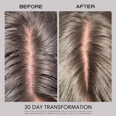 Jupiter Anti-Dandruff Restoring Scalp Serum 2.1 fl oz - New - Image 10