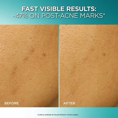 L'Oreal Paris Bright Reveal Dark Spot Exfoliant Peel - Imperfect Box - Image 7