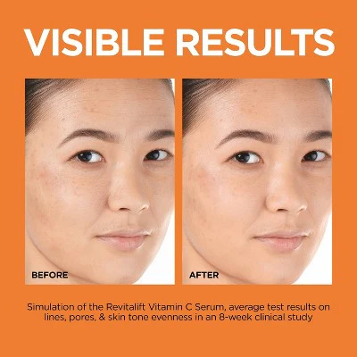 L'Oreal Paris Revitalift 12% Vitamin C + E + Salicylic Serum 1 fl oz - Imperfect Box - Image 5