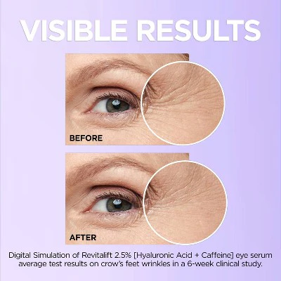 L'Oreal Paris Revitalift Derm Intensives Hyaluronic Acid+Caffeine 0.67 fl oz - Imperfect Box - Image 7