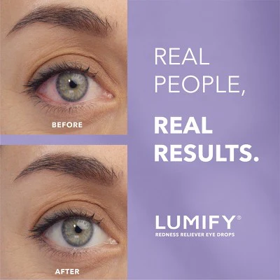 Lumify Eye Drops for Redness Relief 2.5ml - New - Image 3