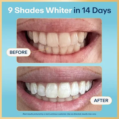 Lumineux Tooth Whitening Strips 14pk - Imperfect Box - Image 2