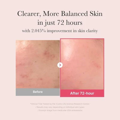 medicube Niacinamide Serum Korean Skincare 1.01 fl oz - Imperfect Box - Image 4