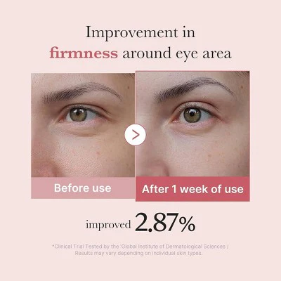 medicube PDRN Pink Peptide Eye Serum Korean Skincare 30ml - Imperfect Box - Image 5
