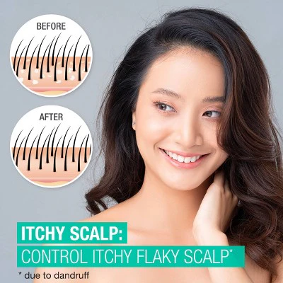 Neutrogena Scalp Therapy Itchy Scalp Shampoo 12 fl oz - Imperfect Container - Image 3