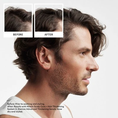 Nioxin System 2 Hair Thickening Natural & Untreated Hair Shampoo & Conditioner Kit 3ct - New - Image 7