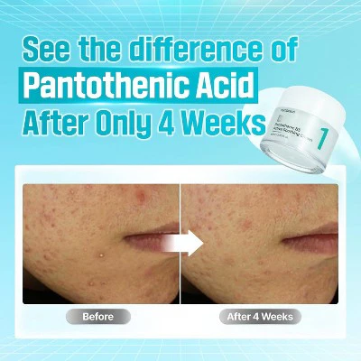 numbuzin No.1 Pantothenic B5 Active Soothing Face Cream 2.7 fl oz - Missing Box - Image 4