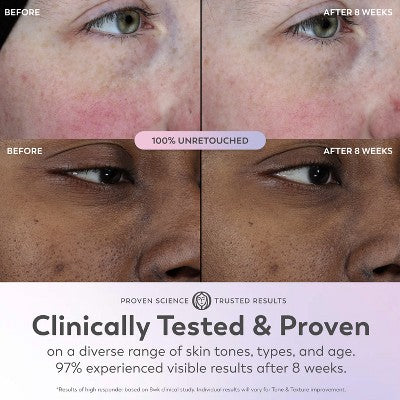 Olay Super Face Serum with Vitamin C 1 fl oz - Imperfect Box - Image 5