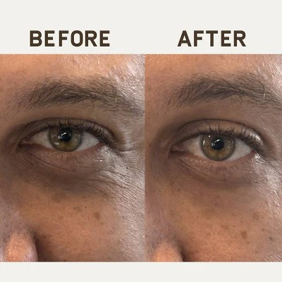 Papatui Ageless Action Technology Under Men's Eye Patch 6ct - Imperfect Box - Image 4