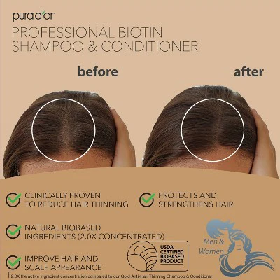 Pura d'or Professional Grade Biotin Conditioner 16 fl oz - Imperfect Container - Image 7