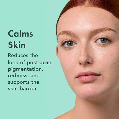 Rael Miracle Clear Complete Acne Treatment Face Serum 1oz - New - Image 5