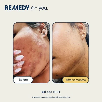 Remedy Skin Serum for Dark Spots and Discoloration 1 fl oz - Missing Box - Image 8