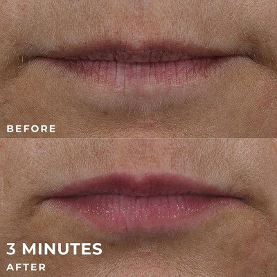 RoC Derm Correxion Lip Volumizer Treatment 0.34 fl oz - Imperfect Box - Image 6