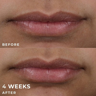 RoC Derm Correxion Lip Volumizer Treatment 0.34 fl oz - Imperfect Box - Image 8