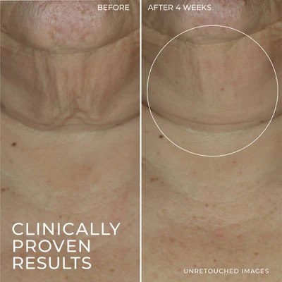 RoC Derm Correxion Retinol Face Stick - Imperfect Box - Image 5