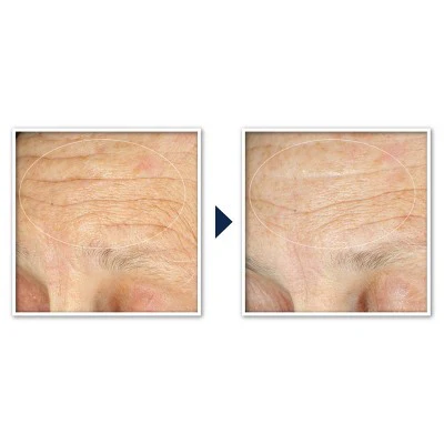 RoC Face & Neck Anti-Aging Moisturizer Firming Cream for Crepey Skin 1.7 fl oz - New - Image 11