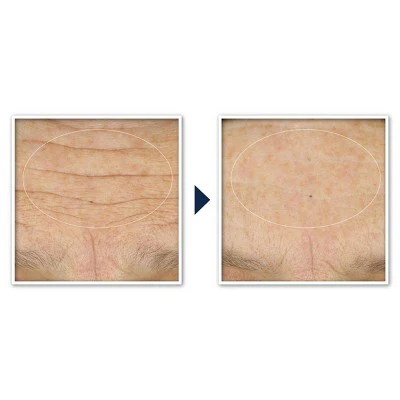 RoC Face & Neck Anti-Aging Moisturizer Firming Cream for Crepey Skin 1.7 fl oz - New - Image 12