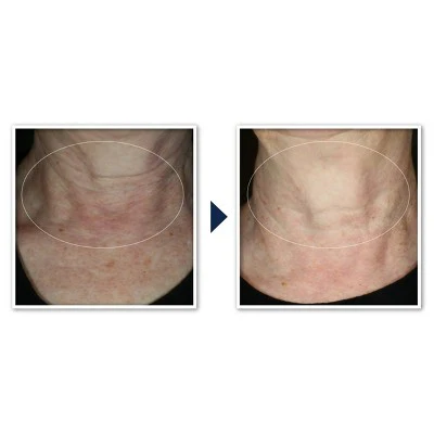 RoC Face & Neck Anti-Aging Moisturizer Firming Cream for Crepey Skin 1.7 fl oz - New - Image 3