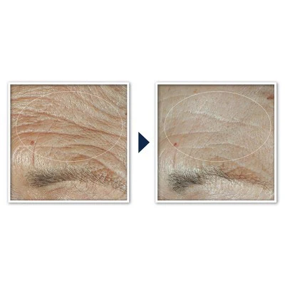 RoC Face & Neck Anti-Aging Moisturizer Firming Cream for Crepey Skin 1.7 fl oz - New - Image 4