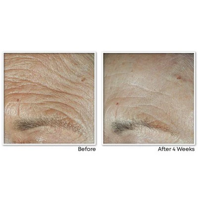 RoC Face & Neck Anti-Aging Moisturizer Firming Cream for Crepey Skin 1.7 fl oz - New - Image 6