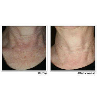 RoC Face & Neck Anti-Aging Moisturizer Firming Cream for Crepey Skin 1.7 fl oz - New - Image 7