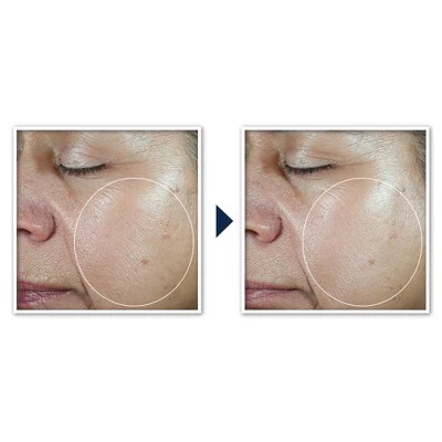 RoC Multi Correxion Even Tone + Lift 5-in-1 Daily Moisturizer SPF 30 1.7oz - Imperfect Box - Image 5