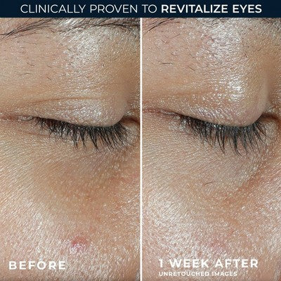 RoC Multi Correxion Revive and Glow Vitamin C Under Eye Balm 0.14oz - Imperfect Box - Image 5