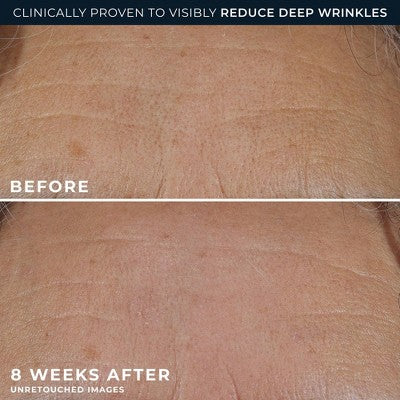 RoC Retinol Correxion Deep Wrinkle Rich Cream 1.7oz - Imperfect Box - Image 11