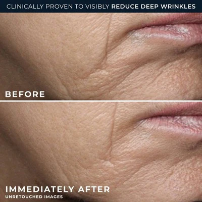 RoC Retinol Correxion Deep Wrinkle Rich Cream 1.7oz - Imperfect Box - Image 5