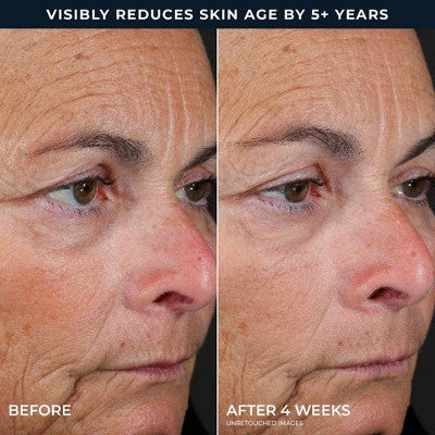 RoC Retinol Correxion Line Smoothing Peel Pads 20ct - Missing Box - Image 5