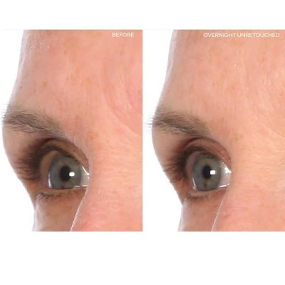SiO Beauty Brow Lift Face Mask 1ct - New - Image 3