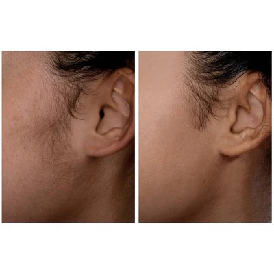 Spa Sciences SIMA Deluxe Sonic Dermaplaning Tool for Exfoliation & Peach Fuzz Removal - Imperfect Box - Image 10