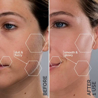 Spa Sciences SIMA Deluxe Sonic Dermaplaning Tool for Exfoliation & Peach Fuzz Removal - Imperfect Box - Image 4