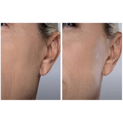 Spa Sciences SIMA Deluxe Sonic Dermaplaning Tool for Exfoliation & Peach Fuzz Removal - Imperfect Box - Image 7