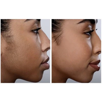 Spa Sciences SIMA Dermaplaning Replacement Safety Tips 6ct - New - Image 5