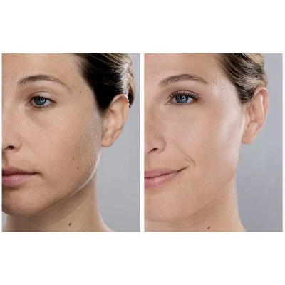 Spa Sciences SIMA Dermaplaning Replacement Safety Tips 6ct - New - Image 6
