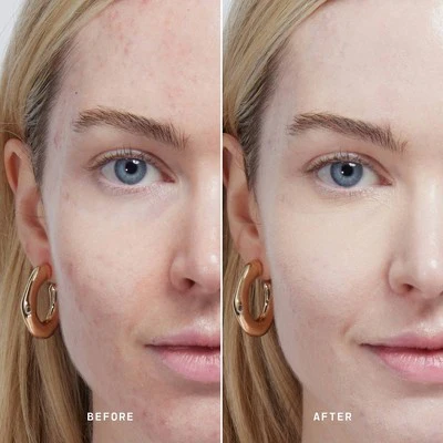 Versed Skin Solution Serum Concealer 2N 0.25 fl oz - New - Image 3