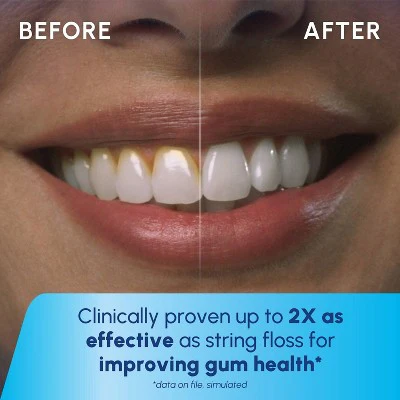 Waterpik Cordless Water Flosser - Imperfect Box - Image 6